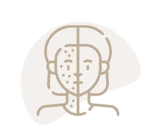 ضدلک و روشن کننده